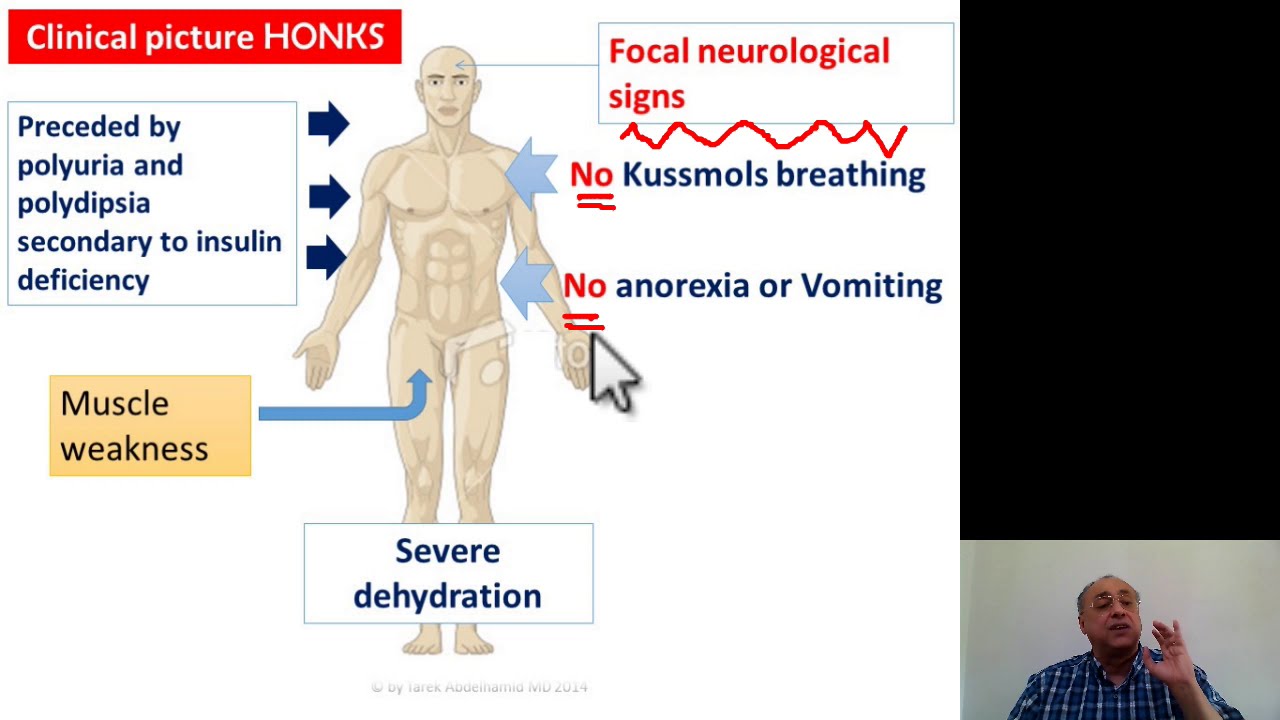 Diabetes Mellitus (5) Quick Review