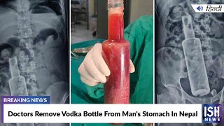 Doctors Remove Vodka Bottle From Man's Stomach In Nepal