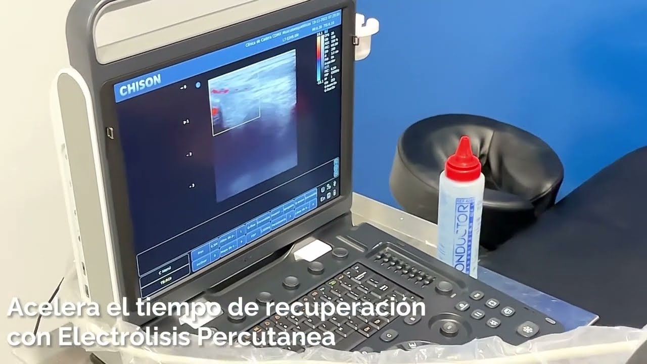 Iván Hernández Peralta-39