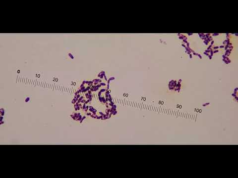 Viewing Gram stain on the microscope