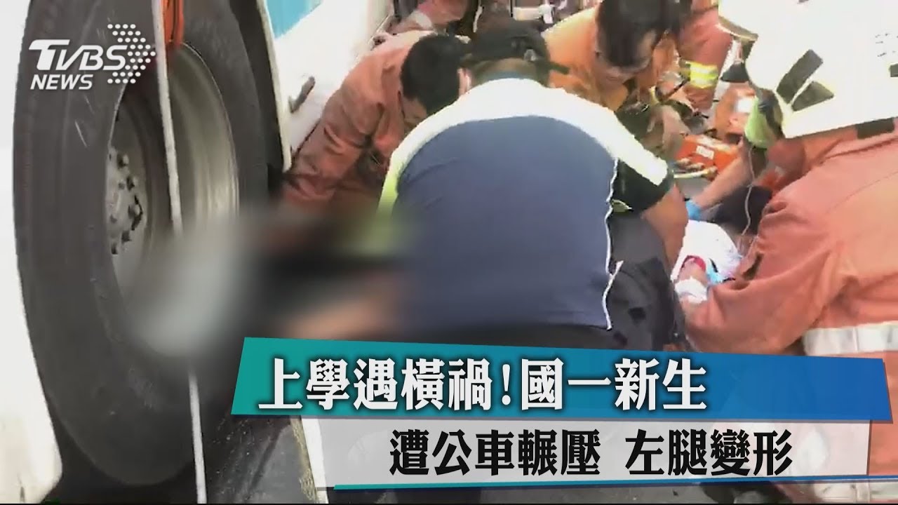 上學遇橫禍!國一新生遭公車輾壓 左腿變形