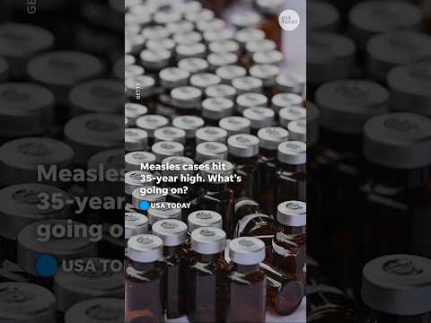 Graphics capture the resurgence of measles, once eliminated in the US