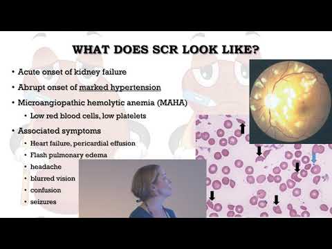 Renal Issues and Scleroderma - 2018 Patient Education Day