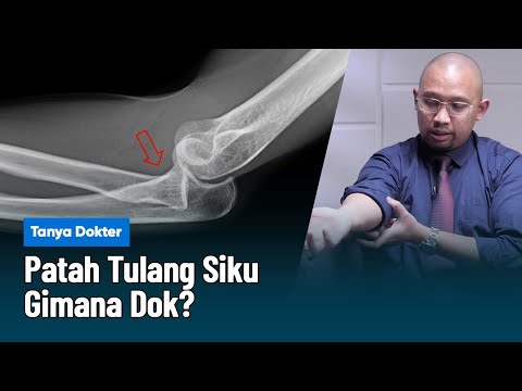Reaksi film “The Art of Self Defense”, Pasien Patah Tulang, Harus apa Dok? | Kata Dokter
