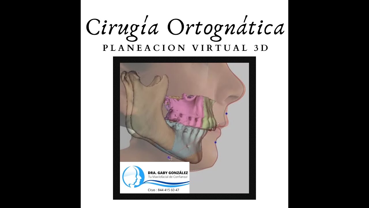 Laura Gabriela González Valdéz-66