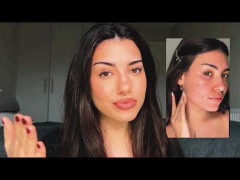 makeup tutorial for acne prone skin (easy – step by step)