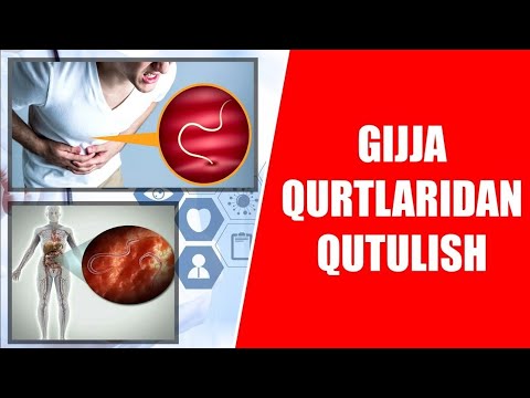 MEDDA QURT va GIJJALAR XAQIDA EKSKLUZIV ma'lumotlar #rek #doctorMuzb #uzbomtv #doctoruz #shortvideo.