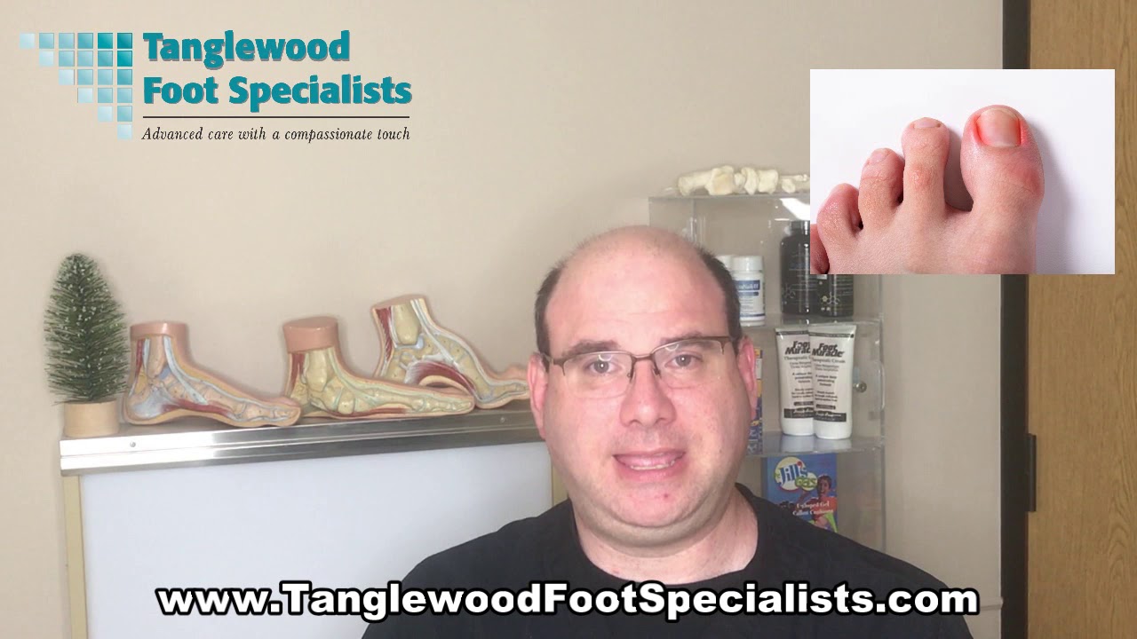 How We Can Make Sure Your Ingrown Toenails NEVER Come Back