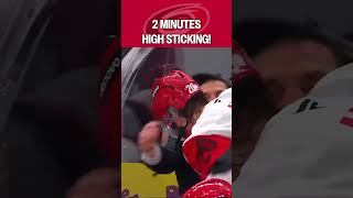 ALWAYS be aware of your stick! ????????
