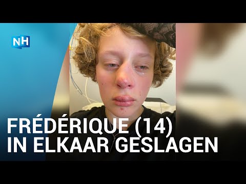 Gebroken neus en tanden: Frédérique afgetuigd nadat ze niet wil zeggen wat haar geslacht is