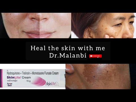 Skinlite cream 25g, packaging type: tube, 25 gm