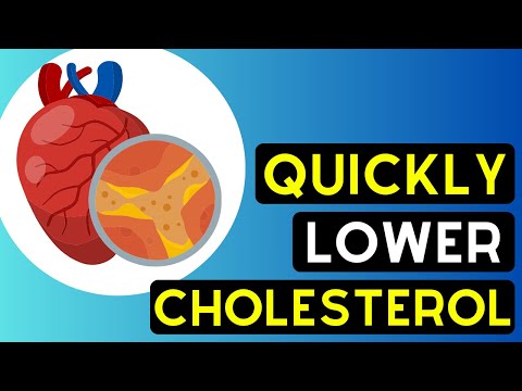 No More High Cholesterol - Eat These Foods Now