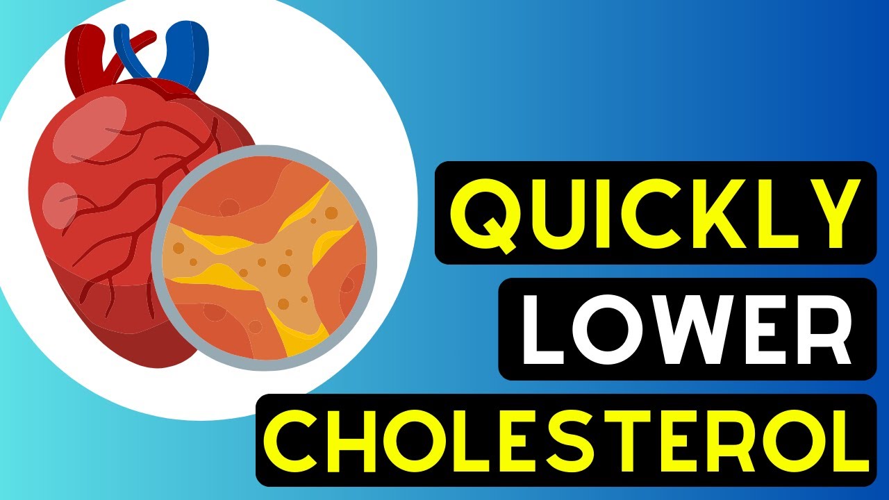 No More High Cholesterol - Eat These Foods Now