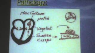 25) Dr. Essam Ezat 7-12-15 [Rheumatic Fever till Endocarditis ]