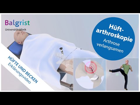 Hüftarthroskopie