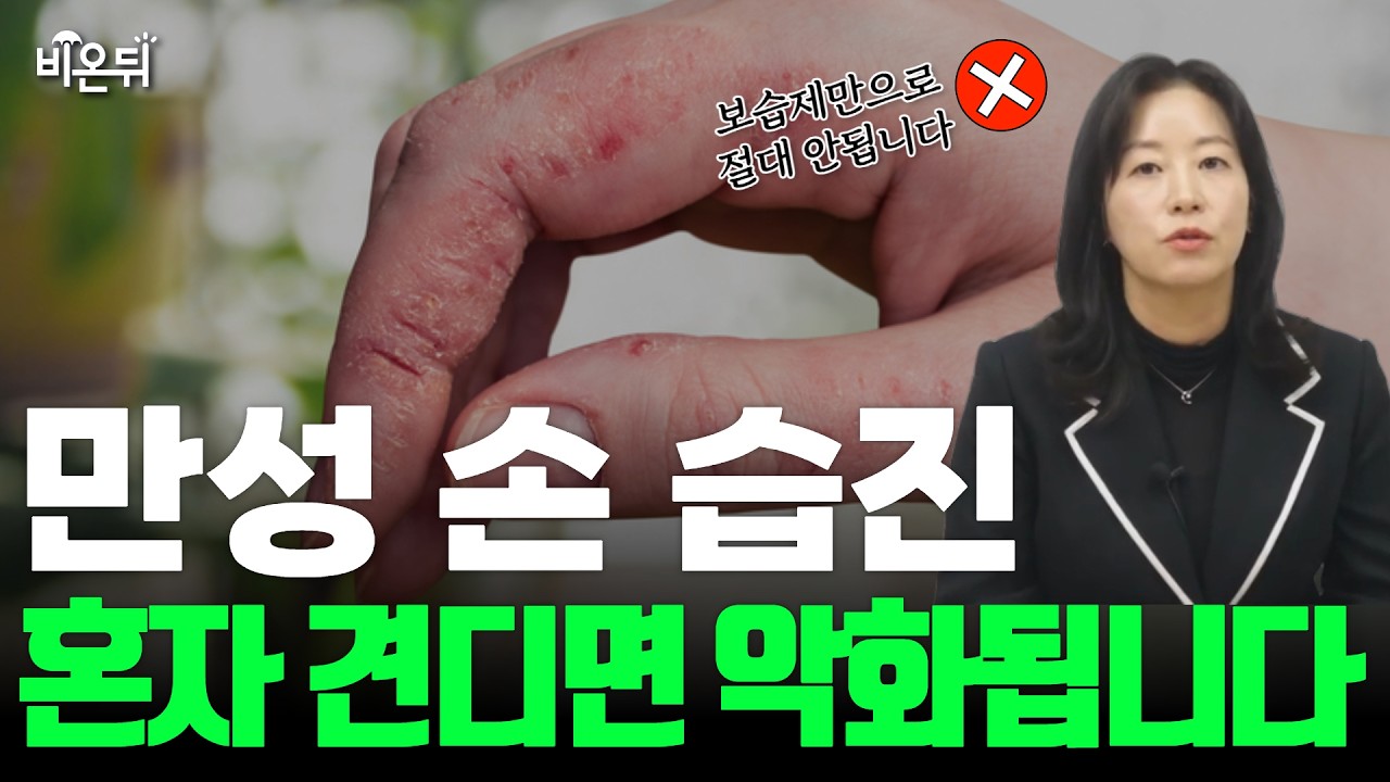 한양대병원 고주연 교수님 관련 영상