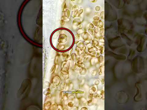 White blood cells ATTACK giant parasite worm!