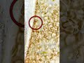 White Blood Cells ATTACK Giant Parasite Worm