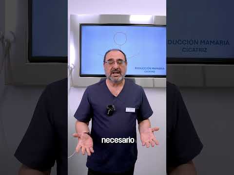 Cicatrices en una Reducción Mamaria