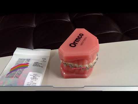 All About Class II Elastics Video  https://www.straightsmilesolutions.com/