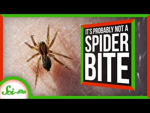 蜘蛛に噛まれたんじゃないの？ (That’s Probably Not a Spider Bite)