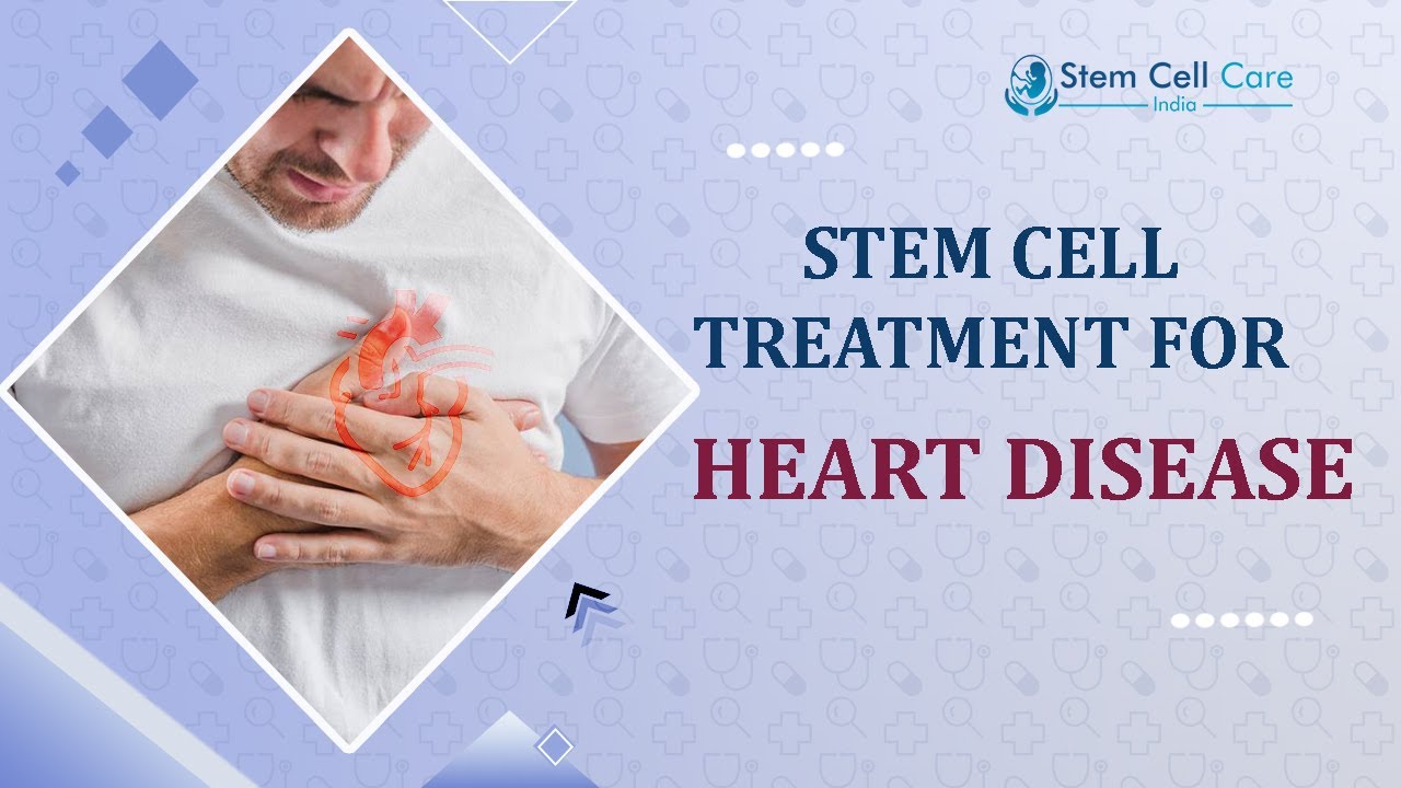 Best Stem Cell Treatment For Heart Disease | Affordable And Effective Treatment | Heart Disease 