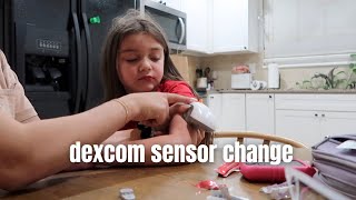 Dexcom CGM sensor change