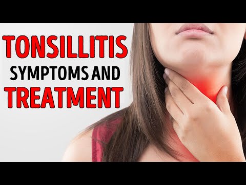 ✅ Tonsillitis || how to treat tonsillitis || tonsillitis symptoms and treatment