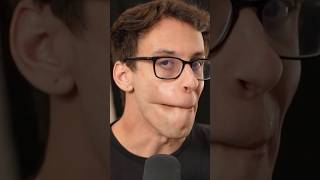 Download lagu My Skin is Weird mp3