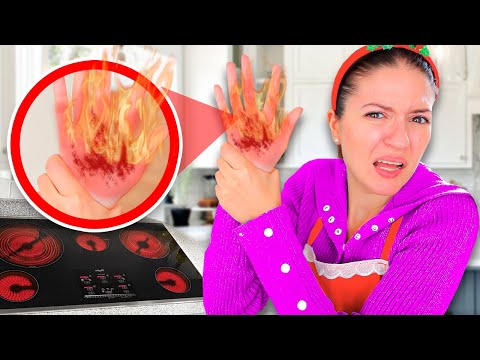 SOFÌ SI FA MALE E SI BRUCI ALLA MANO MENTRE CUCINA!!