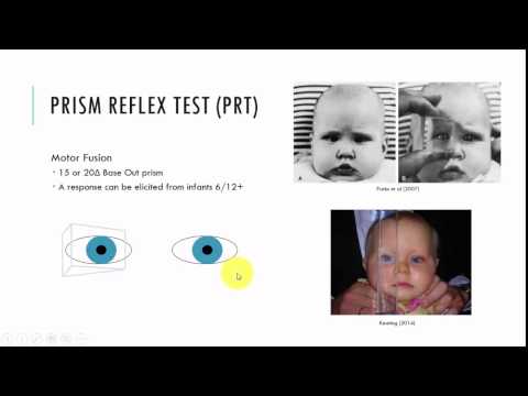 Prism Reflex Test