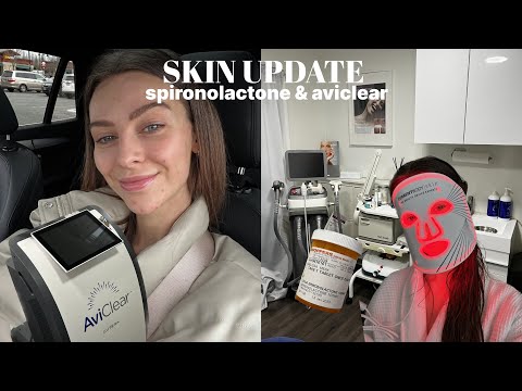 7 month spironolactone (for acne) skin update & starting aviclear