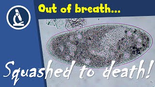 🔬 066 - Why this PARAMECIUM died: Squashed and cell organelles spilling out  | Amateur Science