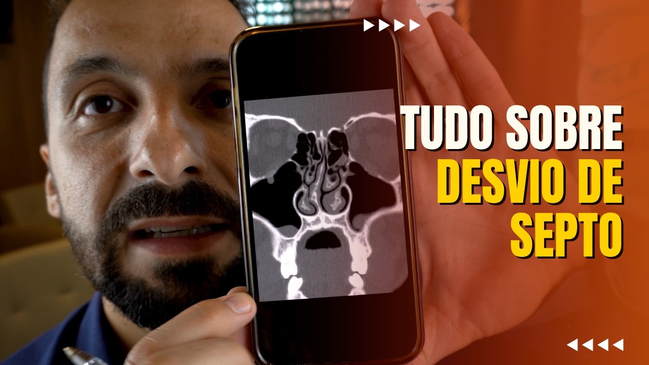 DESVIO DE SEPTO: TUDO QUE VOCÊ PRECISA SABER + QUANDO OPERAR