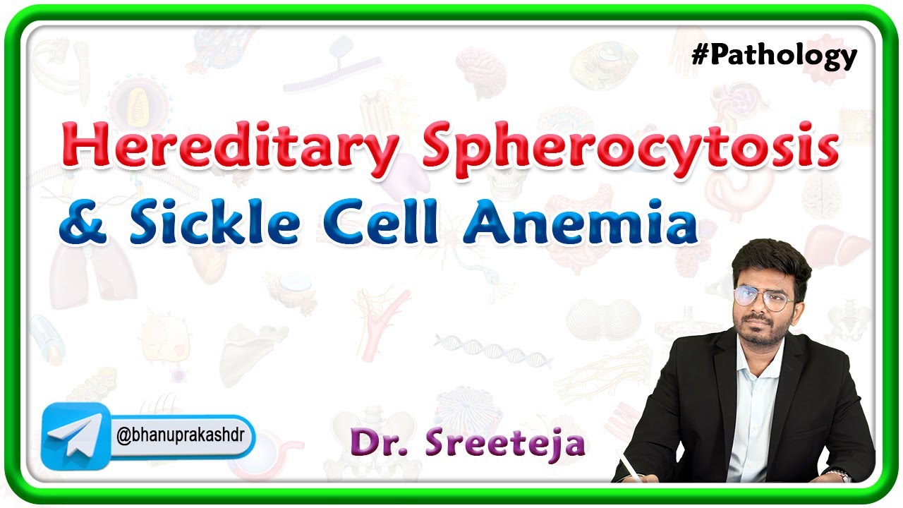 6. Hereditary spherocytosis & Sickle Cell Anemia : USMLE Step 1 Pathology