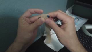 Mallet Finger - Changing Splint