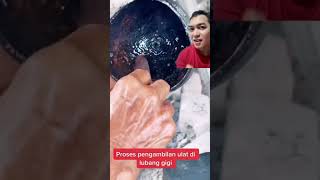 Download lagu Episode 1 : ULat di gigi yang berlubang #doktergigi #mitosataufakta mp3 Download lagu Episode 1 : ULat di gigi yang berlubang #doktergigi #mitosataufakta mp3