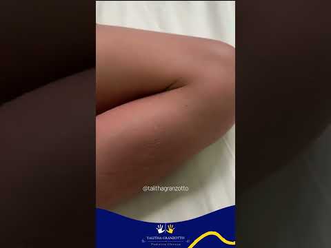 LOCALIZAÇÃO DO PONTINHO F8 | PEDIATRIA CHINESA | PROFª TALITHA GRANZOTTO