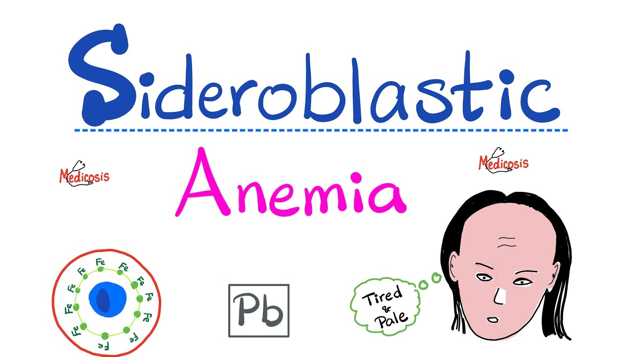 Sideroblastic Anemia