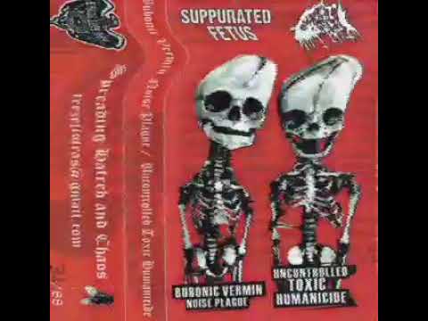 Suppurated Fetus / Reek of the Unzen Gas Fumes - Split