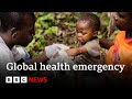 WHO declares mpox outbreak a global health emergency | BBC News