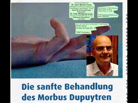 Gelenkschwellung Knie Wunder Fuß im Gelenke