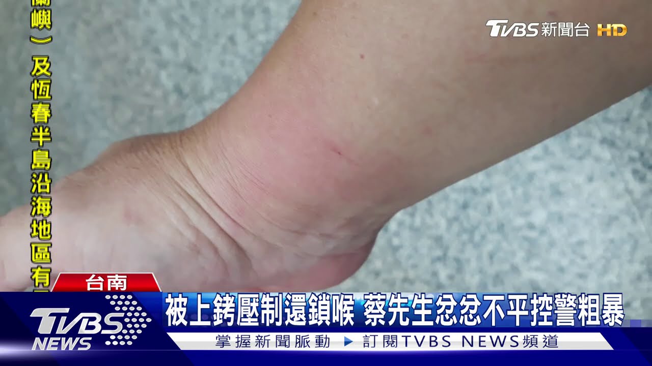 被上銬壓制還鎖喉 蔡先生忿忿不平控警粗暴