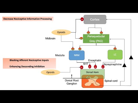 ACUTE PAIN MX: Applying Current Practice Trends in Perioperative Analgesia, Options and Alternatives