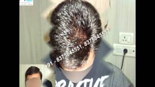 preview picture of video 'MENS WIG SHOPS DEALERS IN DELHI NCR NOIDA GURGAON INDIA'