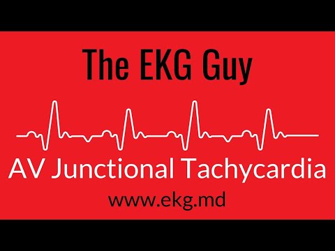 AV Junctional Tachycardia EKG l The EKG Guy - www.ekg.md