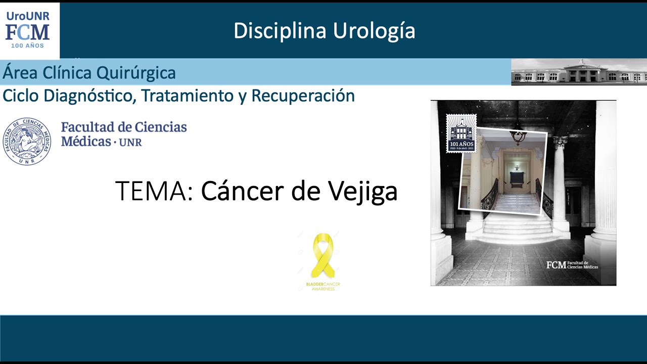 Cáncer de Vejiga. Prof. Dr. Fabián YABER