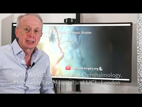 Carlevale intraocular lens haptic erosion repair with scleral recession and patch graft