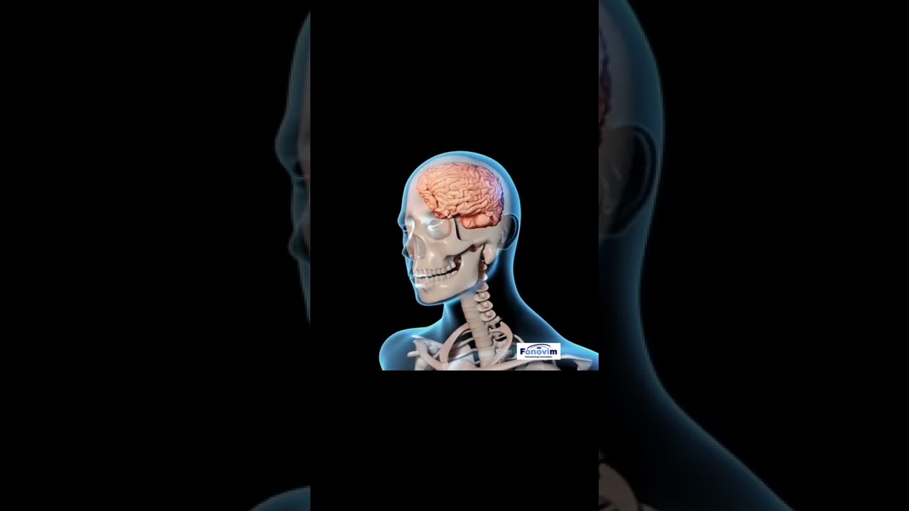 Traumatismo Craniano Encefálico - Fonovim Fonoaudiologia Neurológica