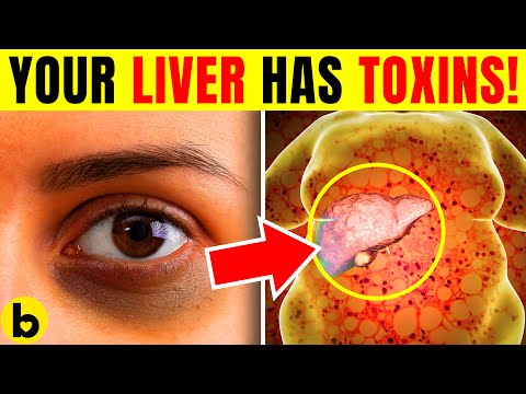10 Warning Signs Your Liver Is Overloaded With TOXINS